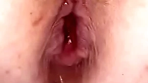 Anal bolt nearby my pest